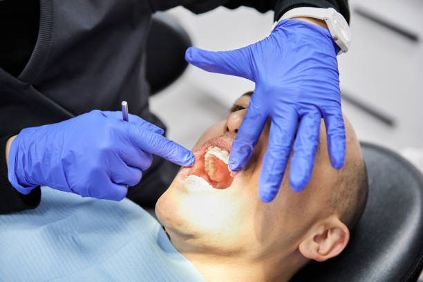 Best Emergency Root Canal Treatment in Washington Heights, NY
